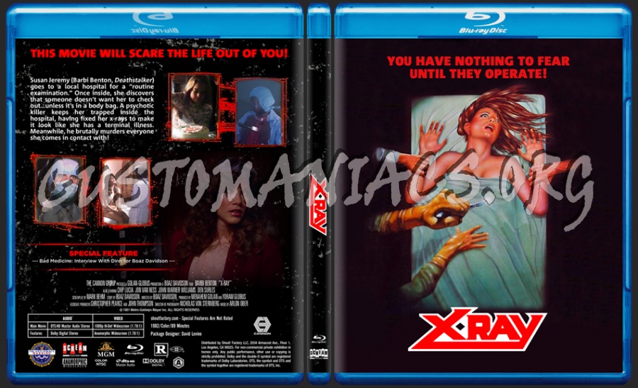 X-Ray (aka Hospital Massacre) dvd cover