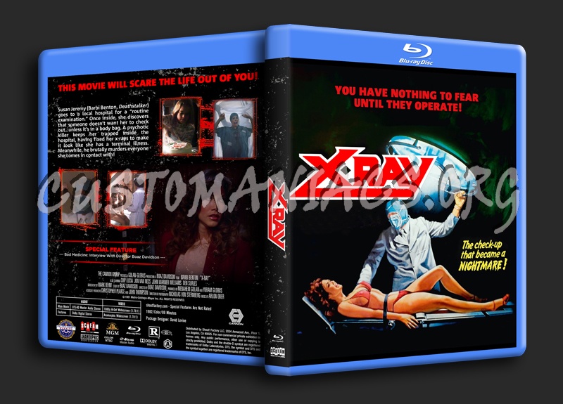 X-Ray (aka Hospital Massacre) dvd cover